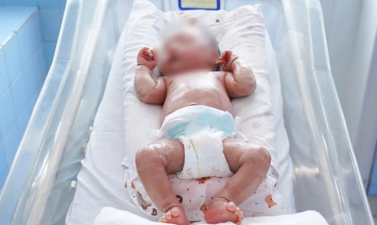 Bé sinh non mắc bệnh vảy cá hồi phục
