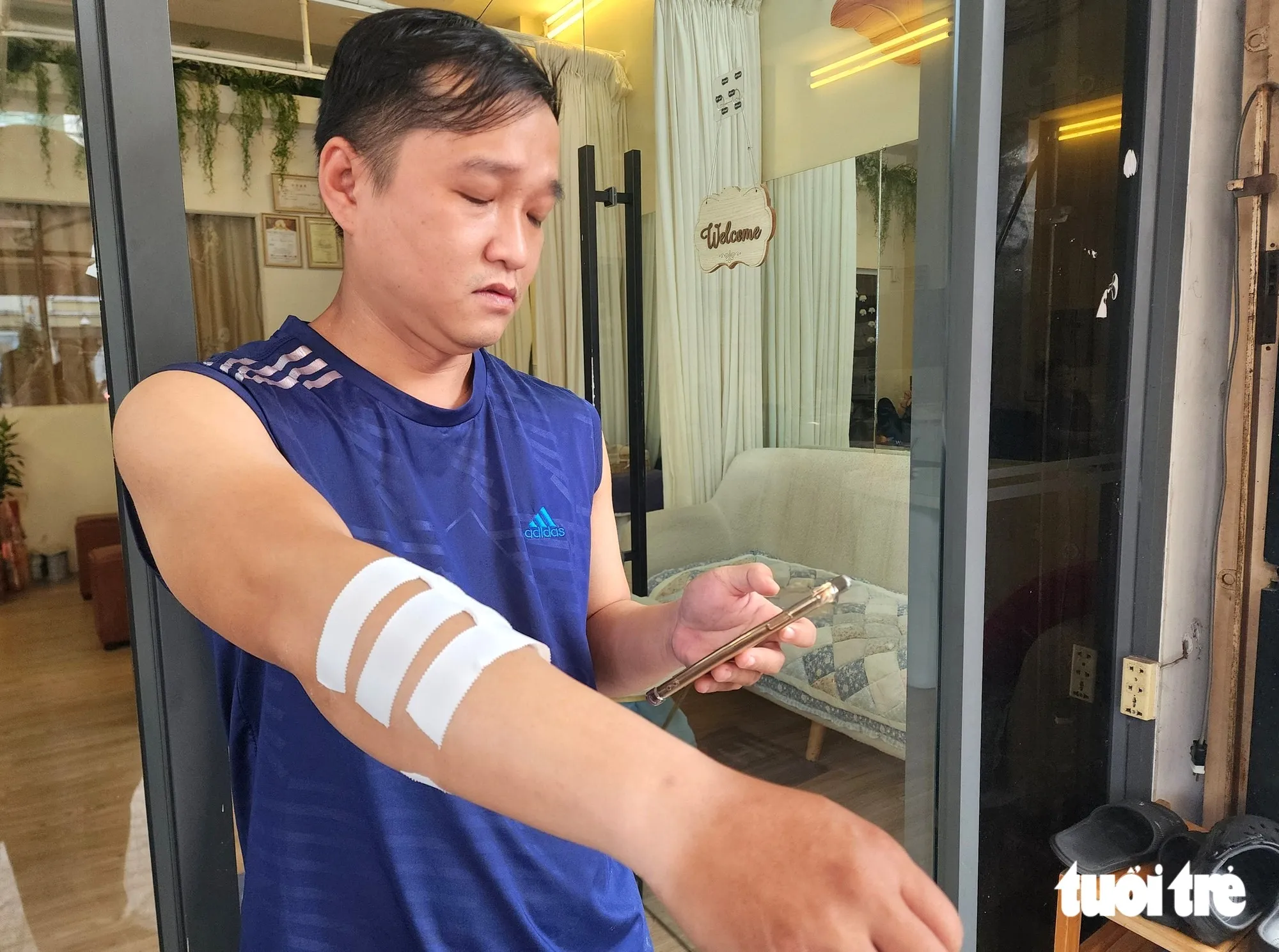 Anh Liêu Chí Phong cho biết anh bị con khỉ cào, cắn ở tay - Ảnh: Ngọc Khải - TTO