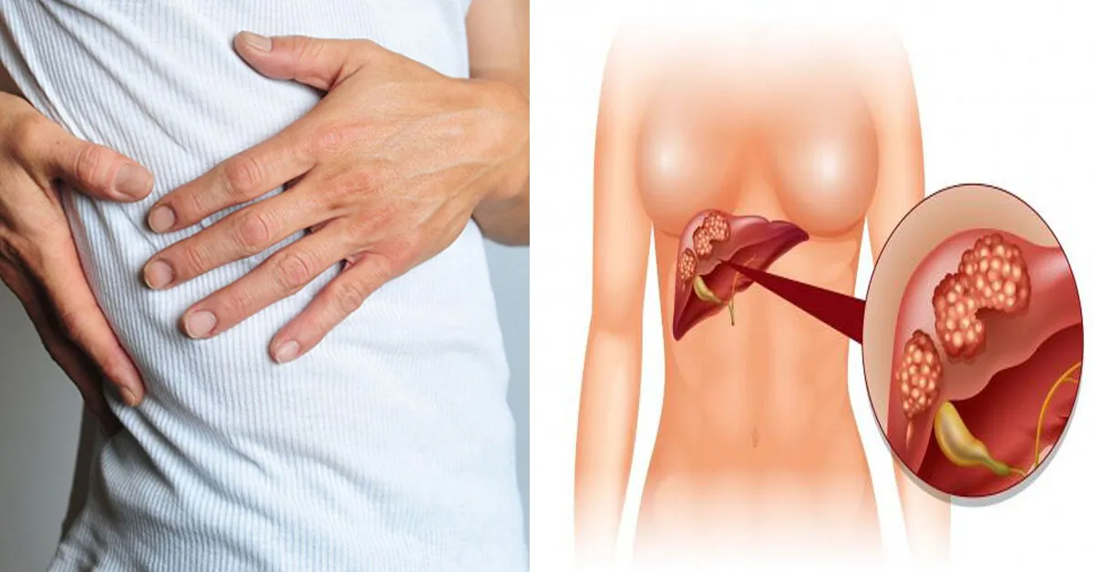 Những đối tượng này cần khám và theo dõi gan ngay lập tức để phòng tránh ung thư