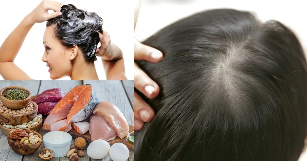 Bật mí 4 cách chăm sóc tóc cho người tóc mỏng