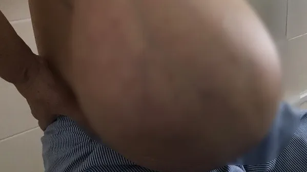 Người phụ nữ mang khối u vú gần 9 kg