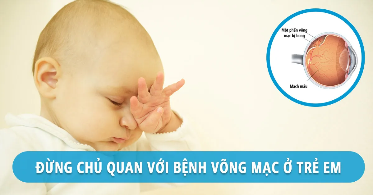 Tìm hiểu về bệnh võng mạc ở trẻ sinh non