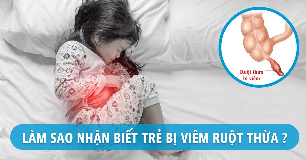 Nhận diện triệu chứng viêm ruột thừa ở trẻ em để điều trị nhanh