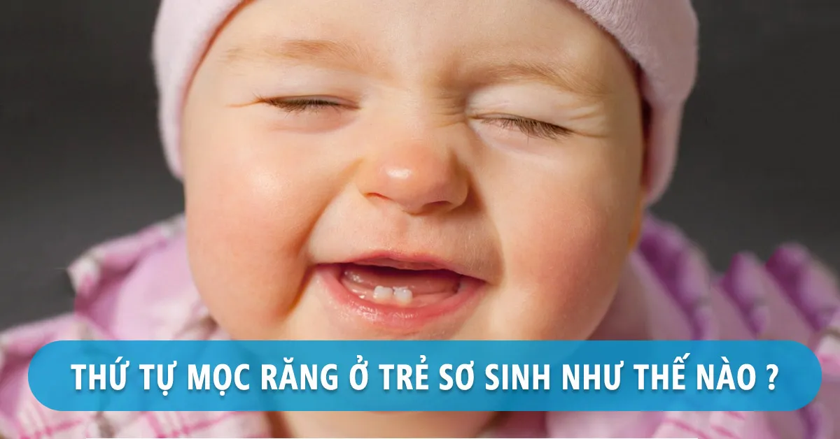 Thứ tự mọc răng của bé cha mẹ nào cũng cần nắm rõ