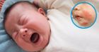 Hiểu đúng về bệnh viêm da cơ địa ở trẻ em