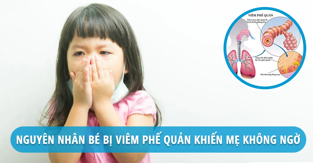 Lý do khiến bé bị viêm phế quản thường xuyên tái phát