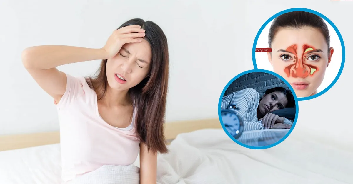 Có thuốc điều trị đau nửa đầu không?