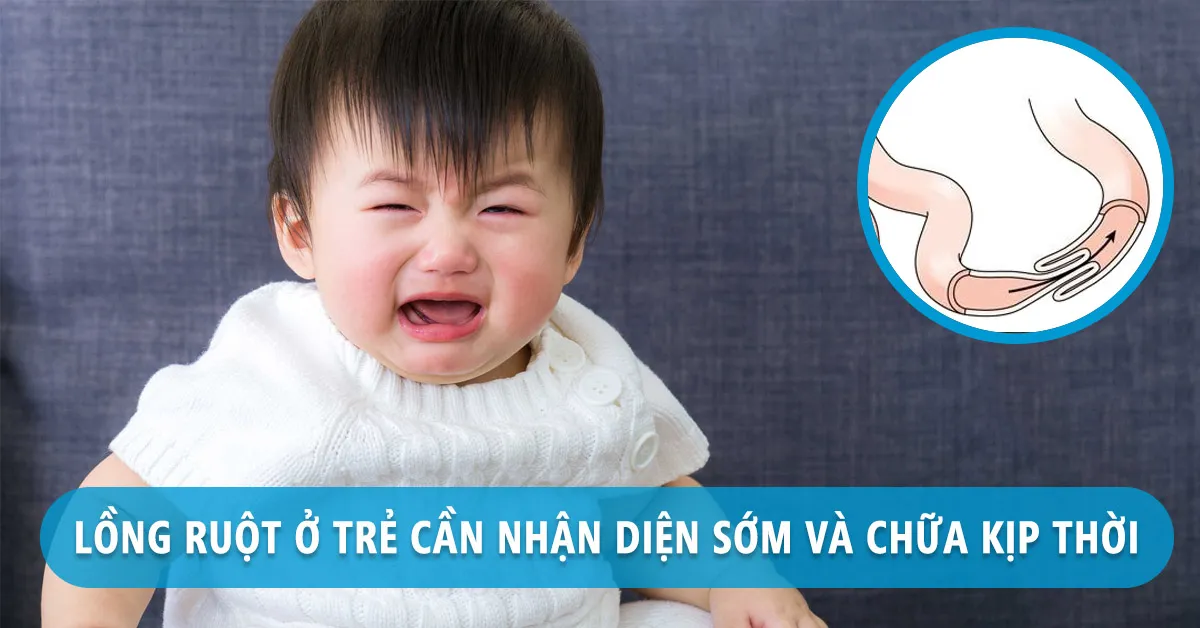 Lồng ruột ở trẻ em có thể nhận biết và điều trị bằng cách nào?