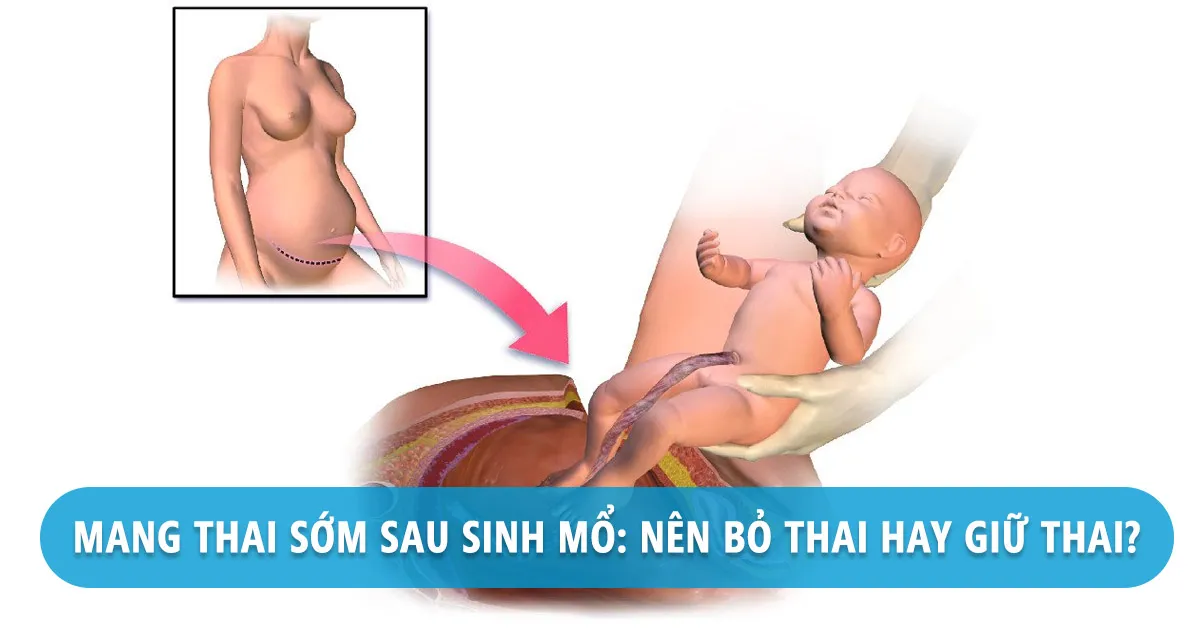 Sinh mổ có thai sớm sẽ phải đối mặt với những nguy hiểm gì?