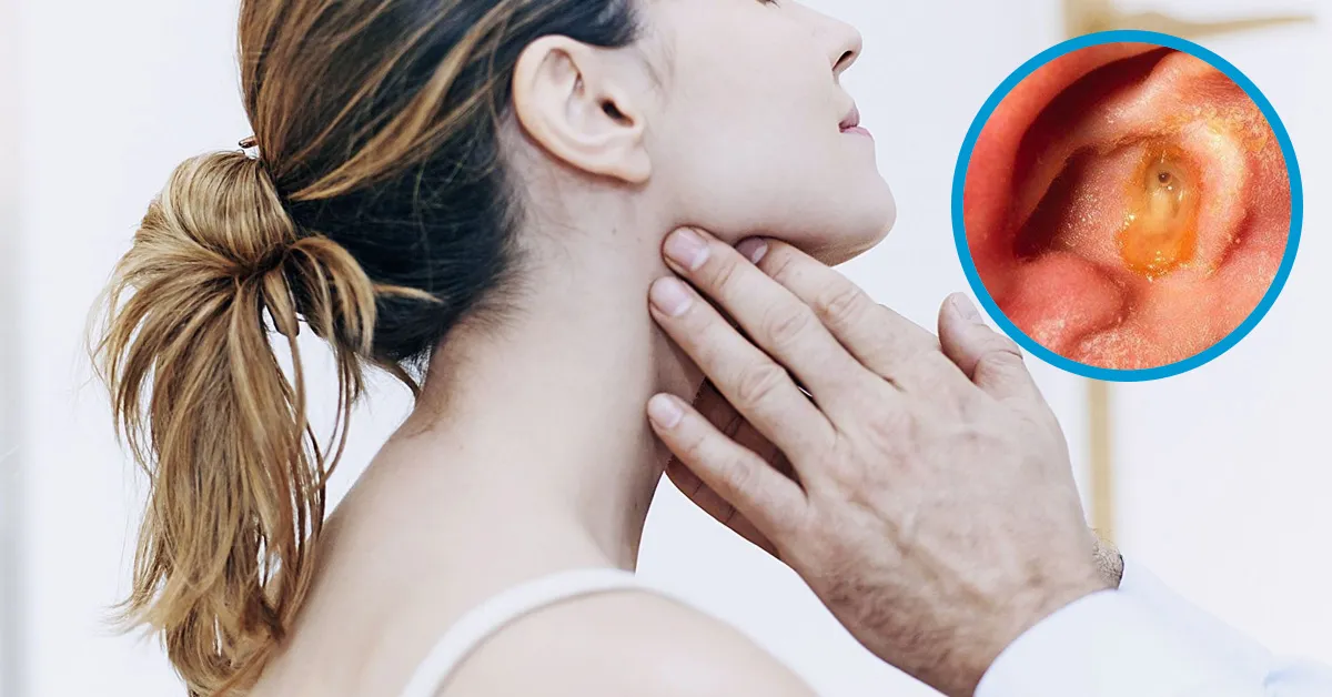 Nổi hạch ở tai có nguy hiểm không?