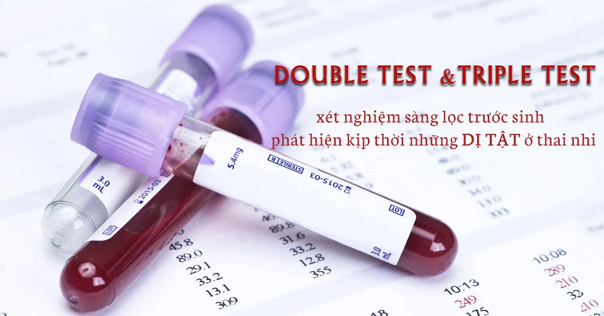 Điều cần biết về xét nghiệm Double test và Triple test trong thai kỳ