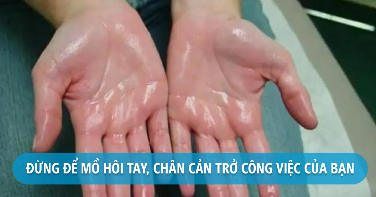 Đổ mồ hôi tay chân trị bằng cách nào hiệu quả nhất?