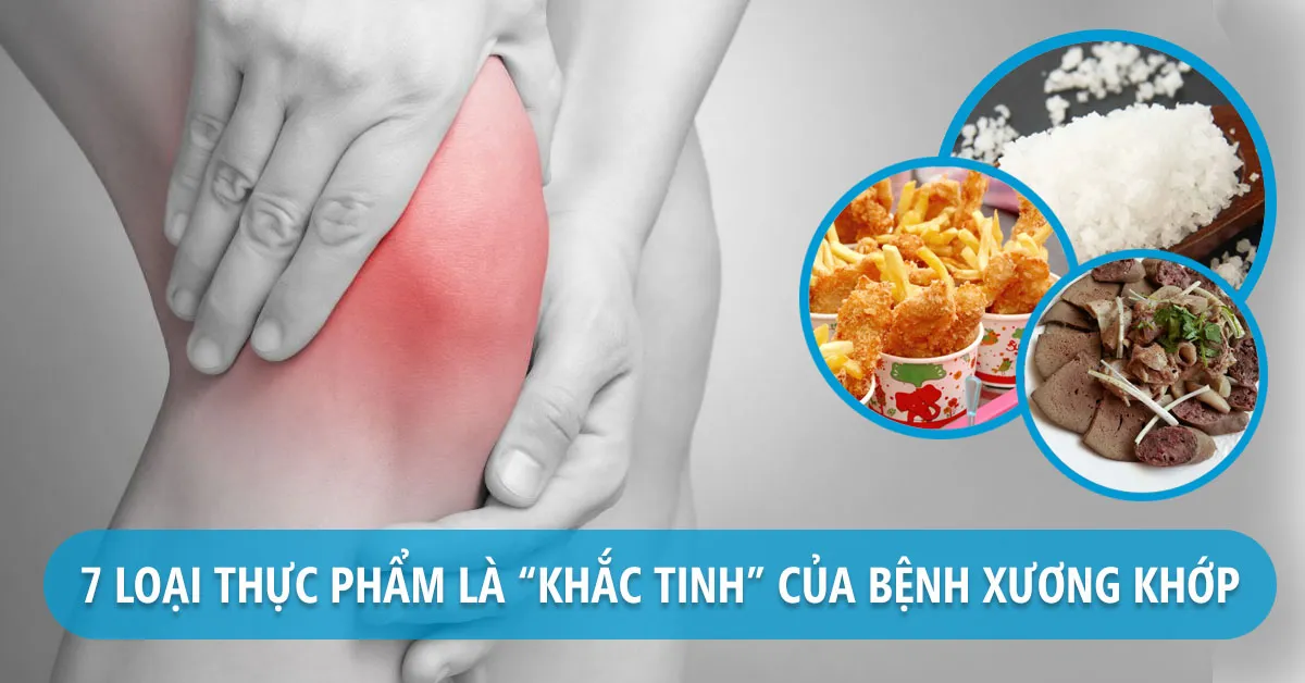 Bệnh xương khớp kiêng ăn gì để đẩy lùi bệnh nhanh chóng