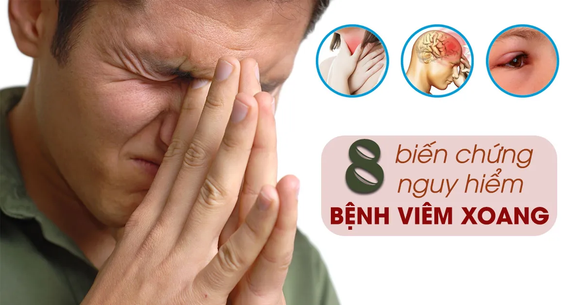 8 biến chứng viêm xoang nguy hiểm cần được cảnh giác
