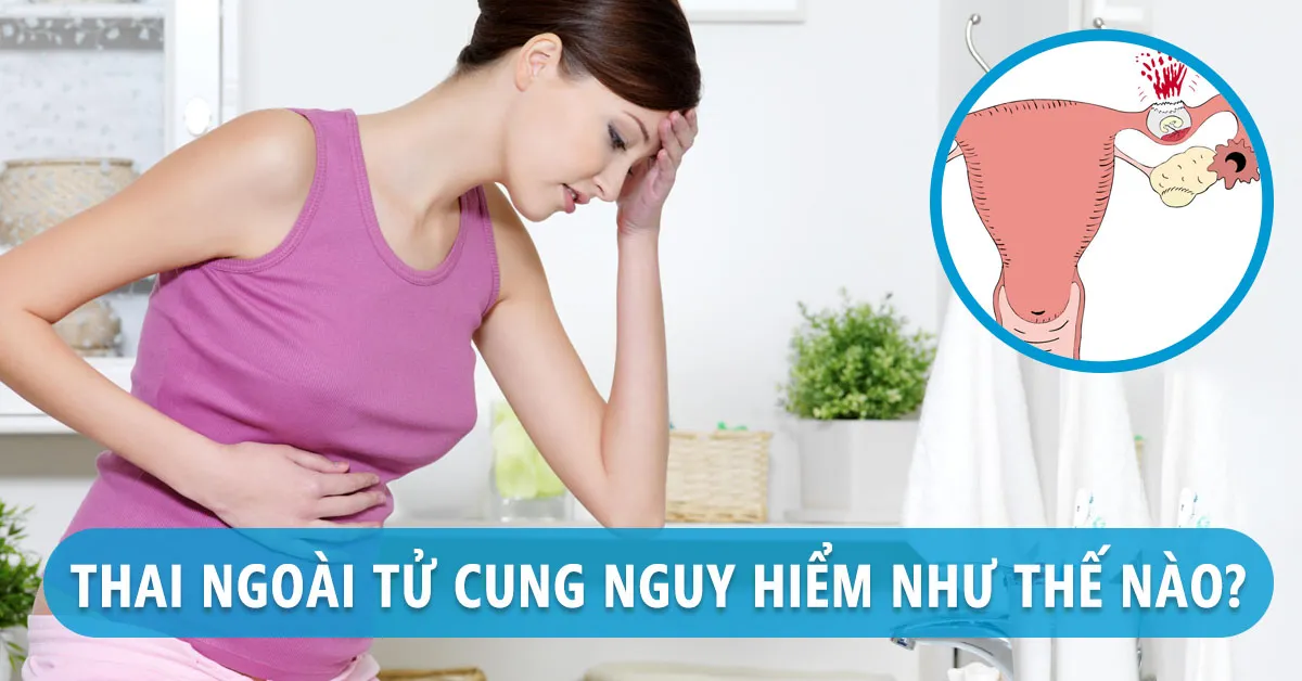 Thai ngoài tử cung là gì? Mang thai ngoài tử cung có giữ được không?