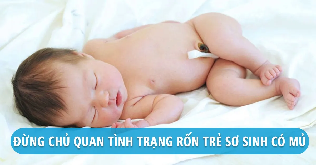 Rốn trẻ sơ sinh có mủ - dấu hiệu nguy hiểm mẹ cần biết