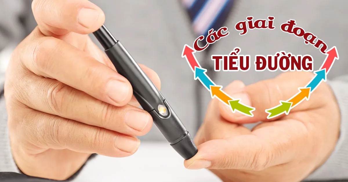 Các giai đoạn của bệnh tiểu đường bạn nên biết