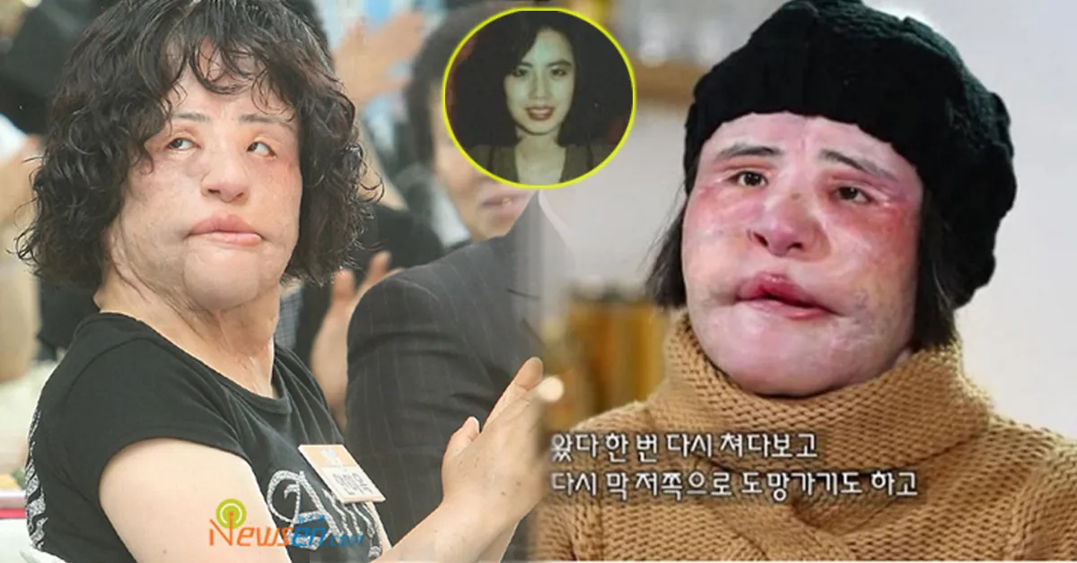 Thảm họa dao kéo xứ Hàn Han Mi Ok qua đời ở tuổi 57