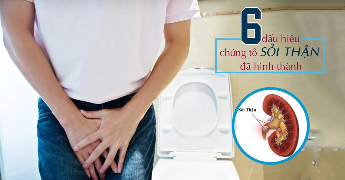 6 triệu chứng sỏi thận chứng tỏ bạn đã mắc bệnh