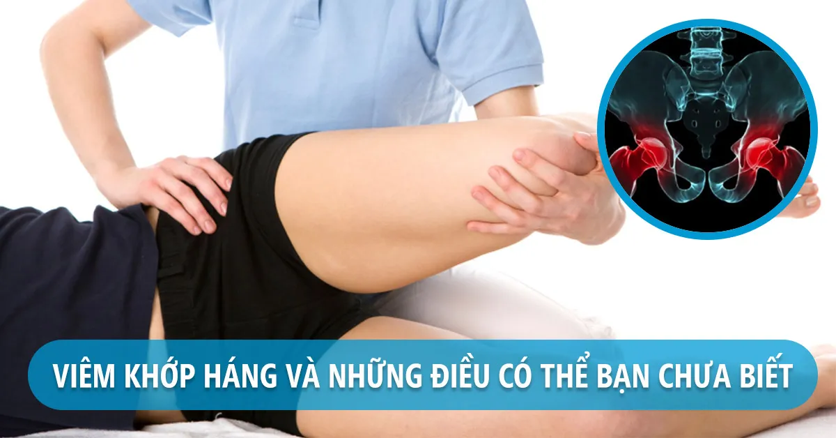 Viêm khớp háng và những điều bạn chưa biết