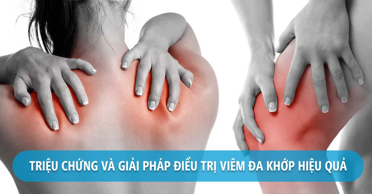 Viêm đa khớp: Nguyên nhân, triệu chứng và cách điều trị