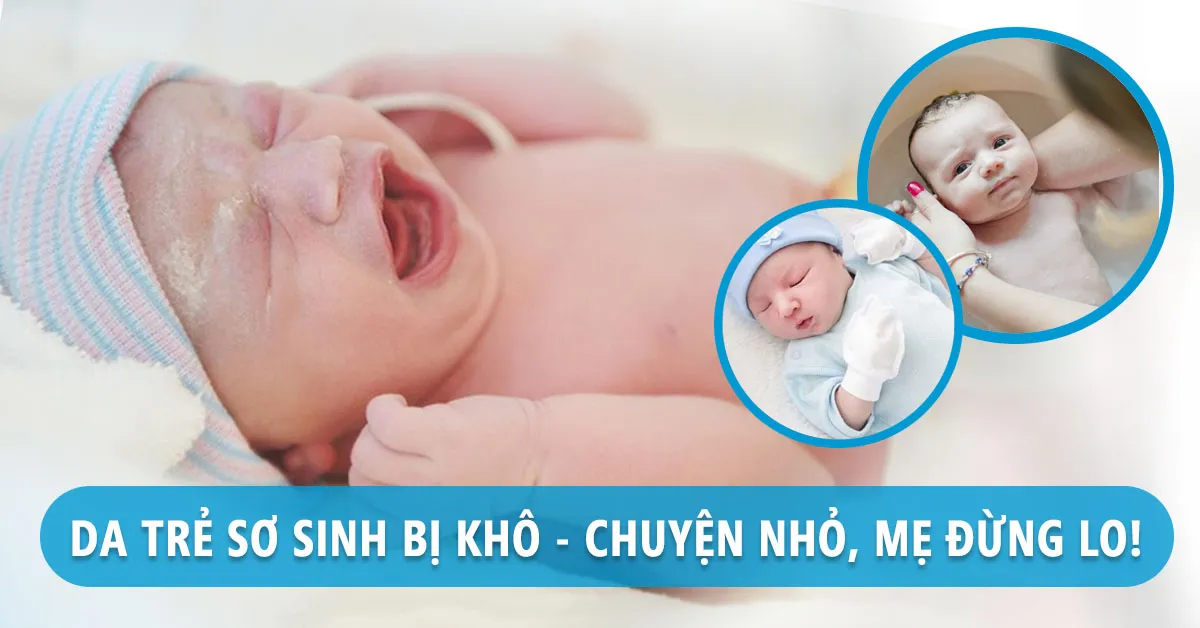 Trẻ sơ sinh bị khô da, mách mẹ cách chăm sóc an toàn!