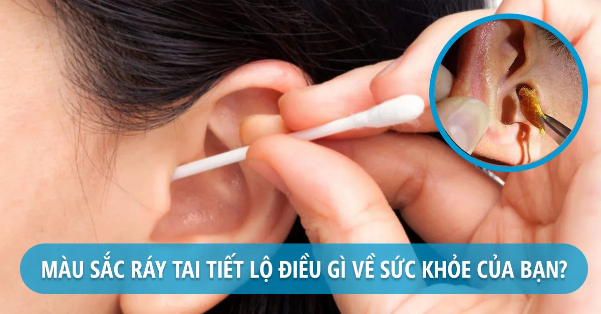 Ráy tai có vai trò gì? Có nên lấy ráy tai thường xuyên không?