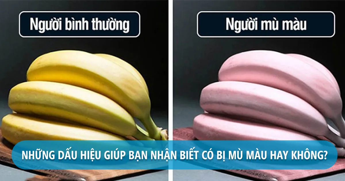 Mù màu là gì? Vì sao bị mù màu?