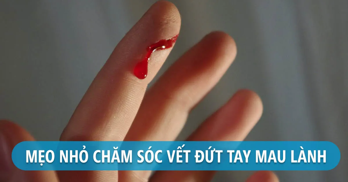 Bị đứt tay phải làm sao để mau lành?