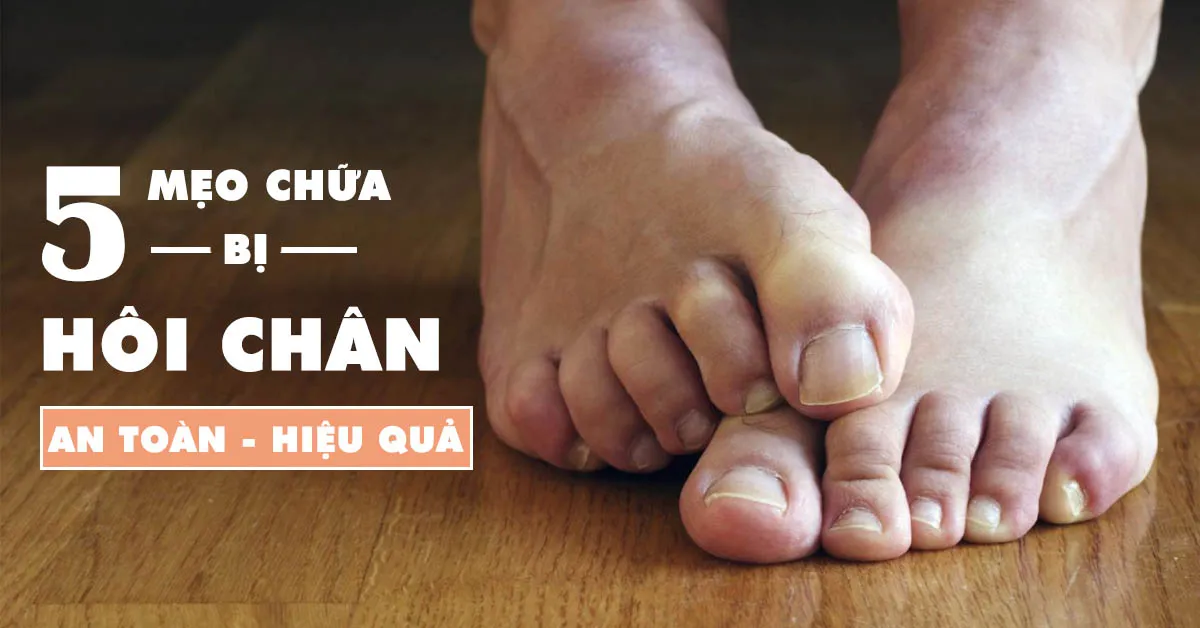 Bí quyết chữa ra mồ hôi chân, đánh tan chứng hôi chân hiệu quả