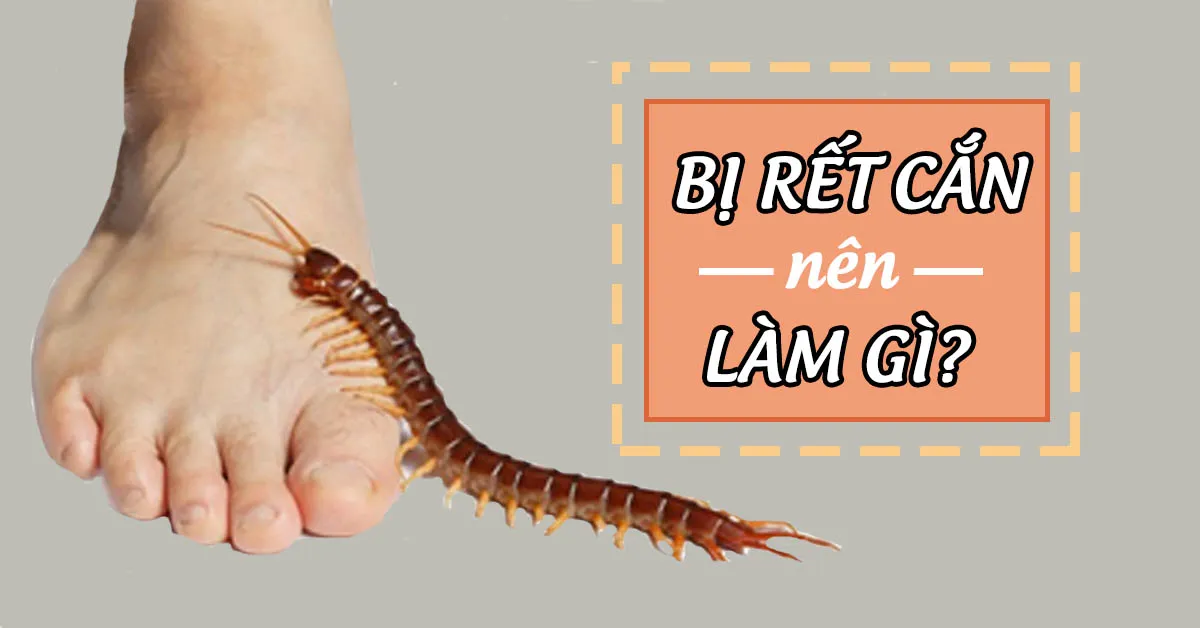 Bị rết cắn phải làm sao?