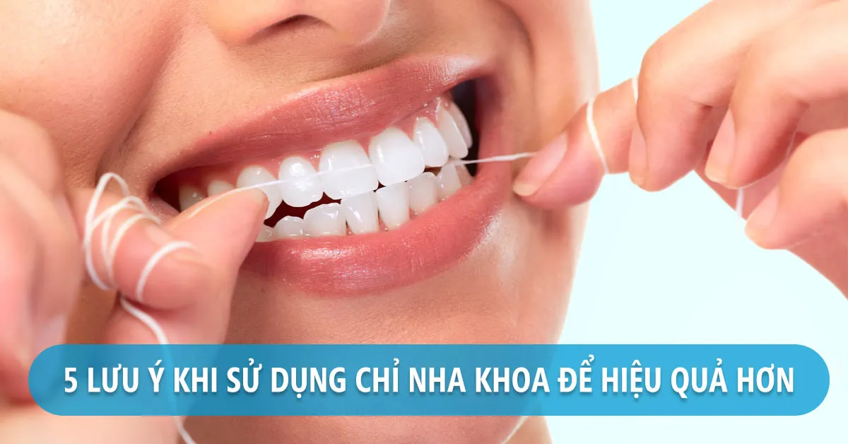 Cách dùng chỉ nha khoa để vệ sinh răng đúng cách