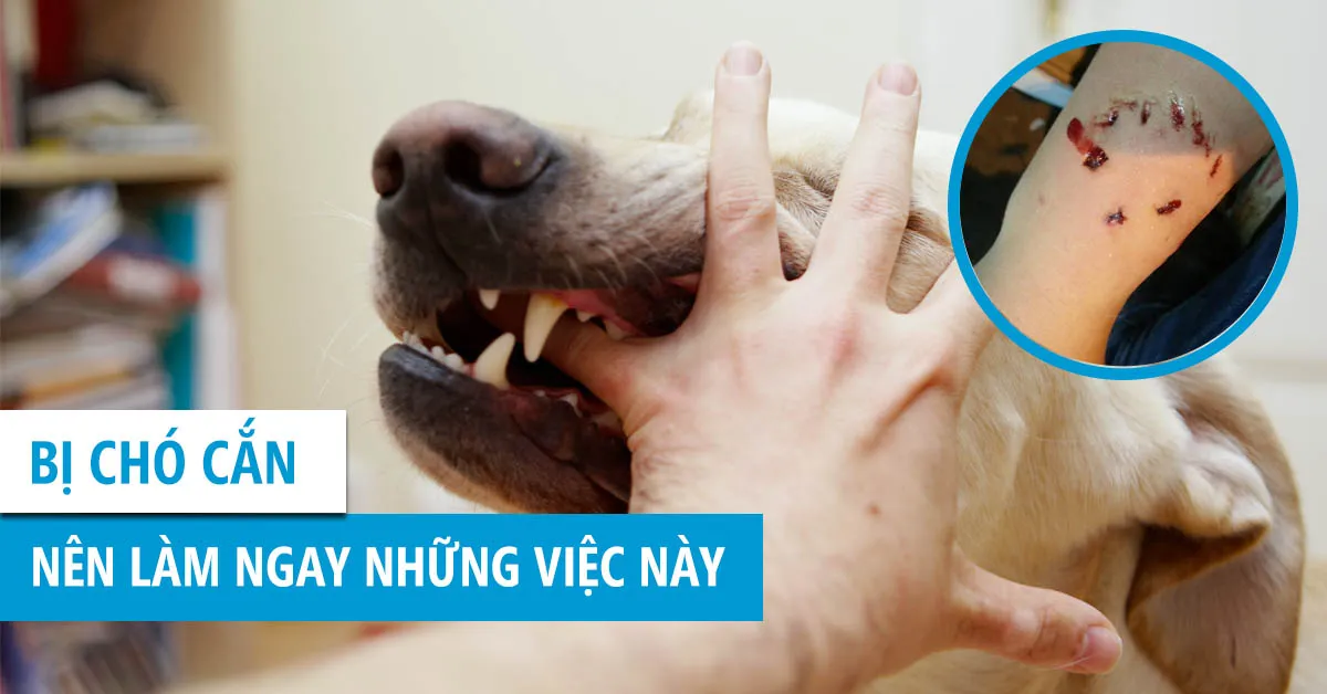 Chó cắn phải xử lý như thế nào cho an toàn?