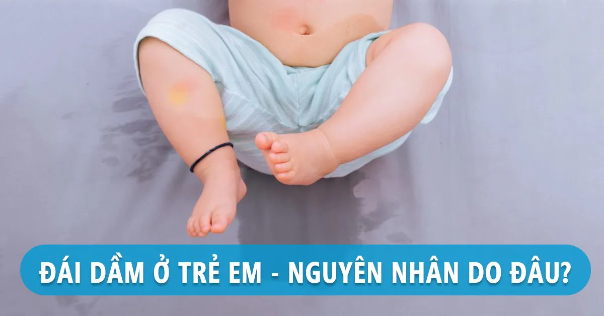 Hiểu đúng nguyên nhân gây đái dầm ở trẻ để chữa đúng cách