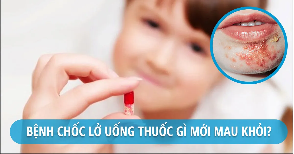 Bệnh chốc lở dùng thuốc gì?