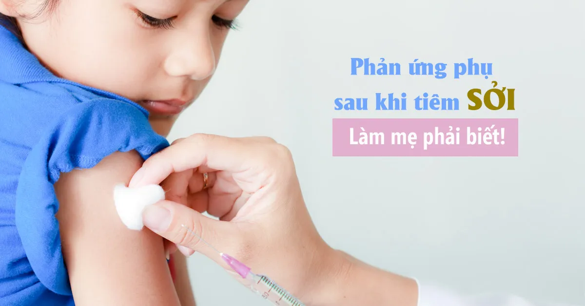 Tiêm sởi có sốt không?