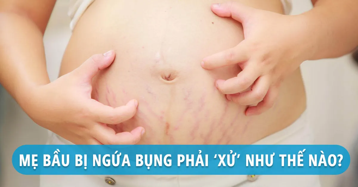 Những nguyên nhân khiến bà bầu bị ngứa bụng và cách khắc phục