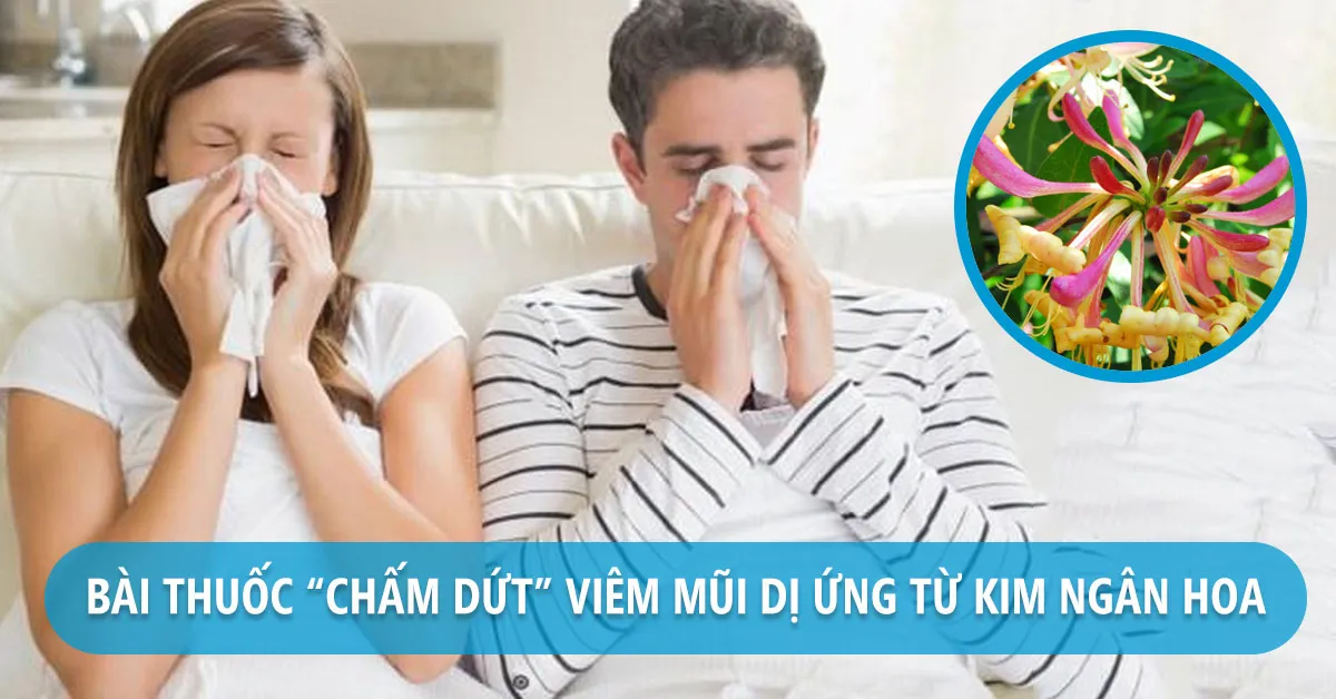 Chữa viêm mũi dị ứng bằng kim ngân hoa có hiệu quả không?