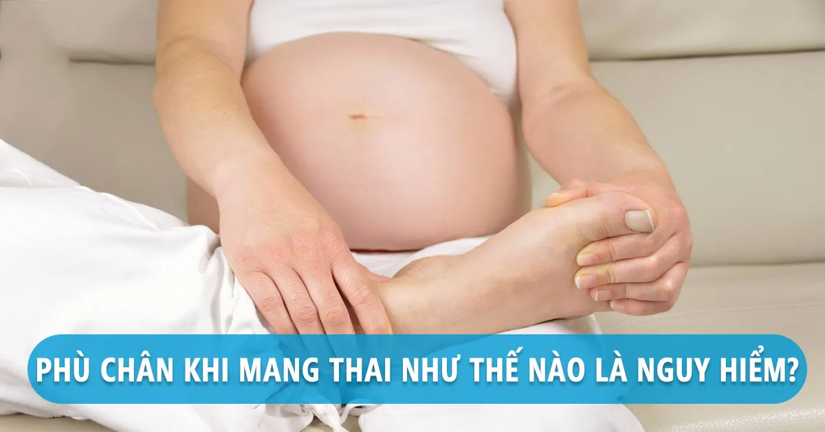 Những điều mẹ cần biết về hiện tượng phù chân khi mang thai