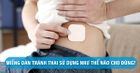 Miếng dán tránh thai: Lợi và hại như thế nào?