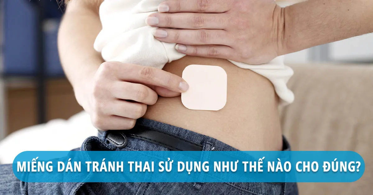 Miếng dán tránh thai: Lợi và hại như thế nào?