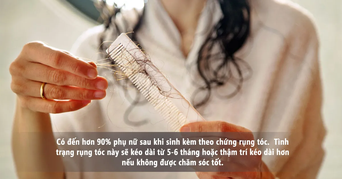 Rụng tóc sau sinh, nguyên nhân vì sao?