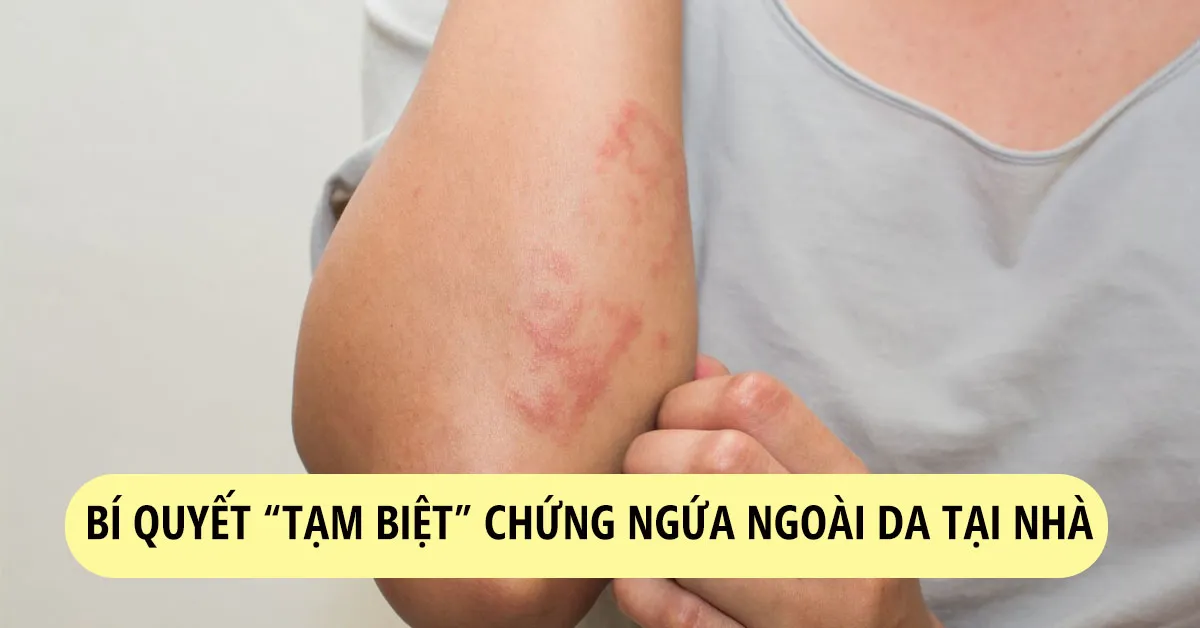 Bệnh ngứa ngoài da và mẹo điều trị