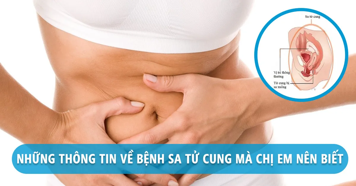 Sa tử cung là bệnh gì, điều trị được không?