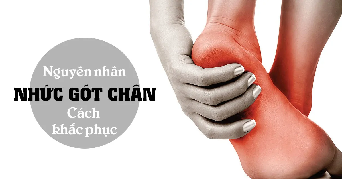 Cách chữa nhức gót chân bằng nguyên liệu tự nhiên