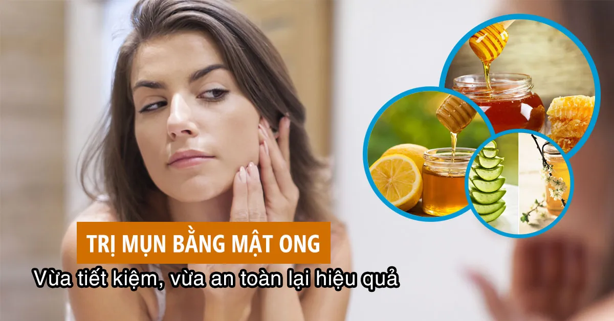 Trị mụn bằng mật ong với những công thức đơn giản