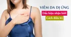 Viêm da dị ứng và thuốc điều trị
