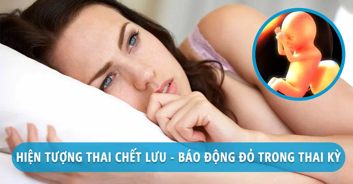 Thai lưu – Dấu hiệu cảnh báo và cách phòng ngừa