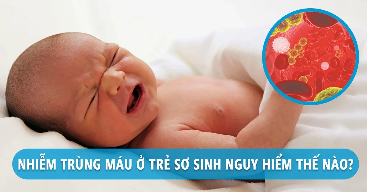 Đừng chủ quan với bệnh nhiễm trùng máu ở trẻ sơ sinh