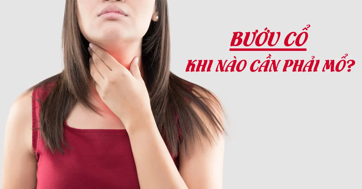 Bướu cổ: Dấu hiệu nhận biết, nguyên nhân và cách điều trị